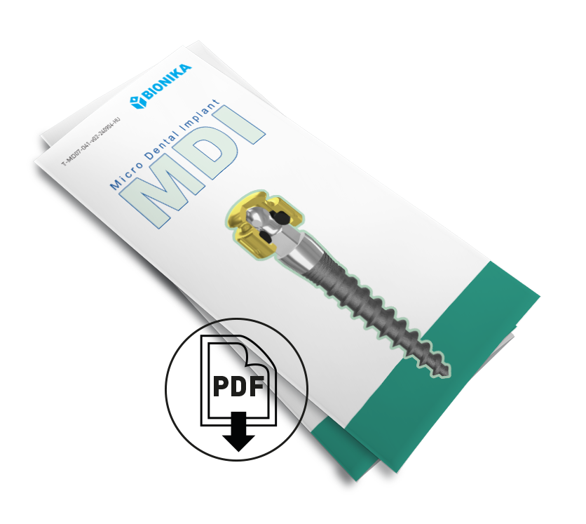MDI-trifold-ikon Innen letölthető az MDI implantációs rendszer katalógusa, pdf formátumban.