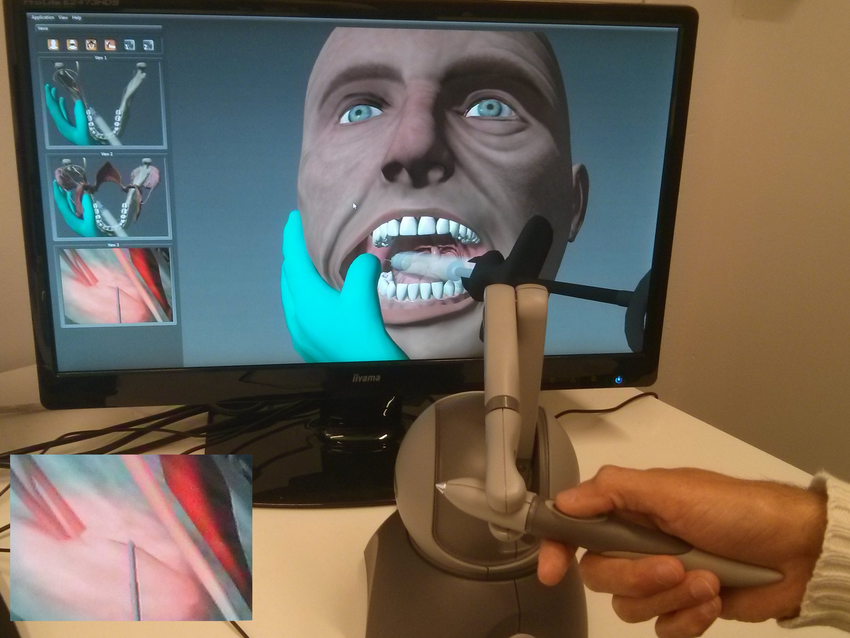Injection-of-local-anaesthesia-in-the-right-side-of-the-virtual-patient