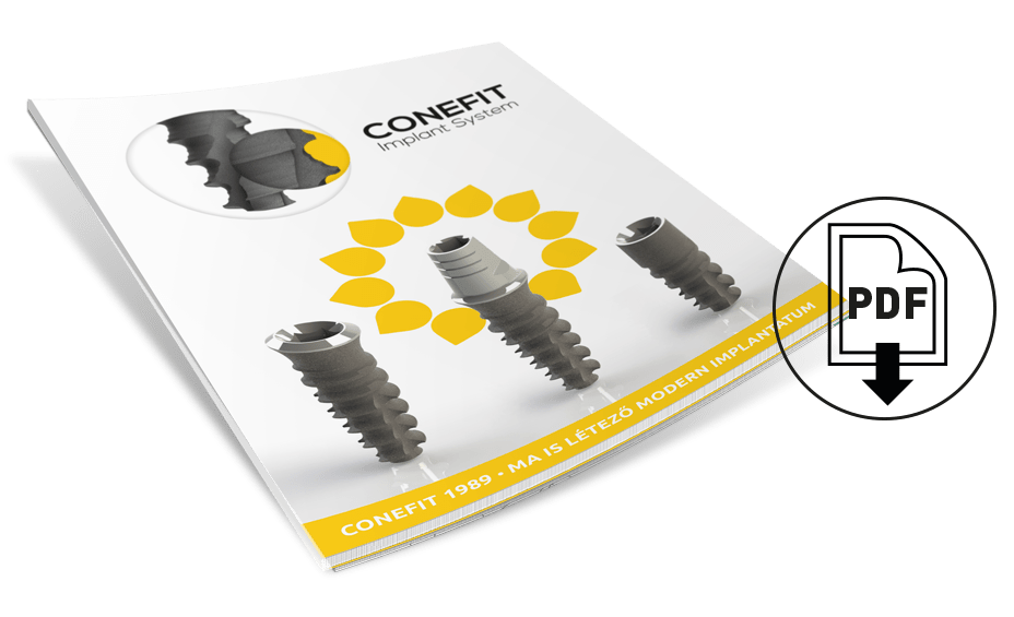 Download our Conefit catalogue in pdf format!