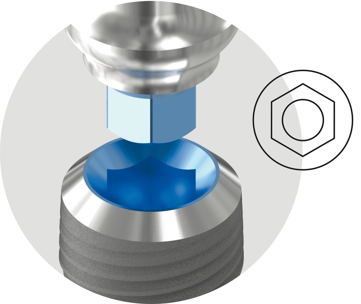 BIONIKA Medis Implant System- connection