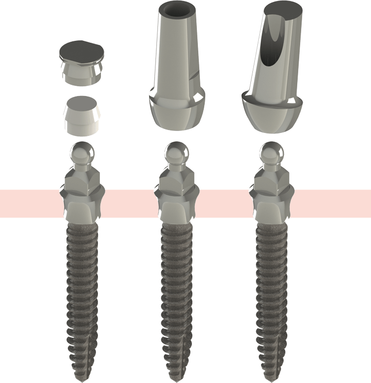 A Nanoplant implantátumok anatómiai fej felépítményekkel is kaphatóak.