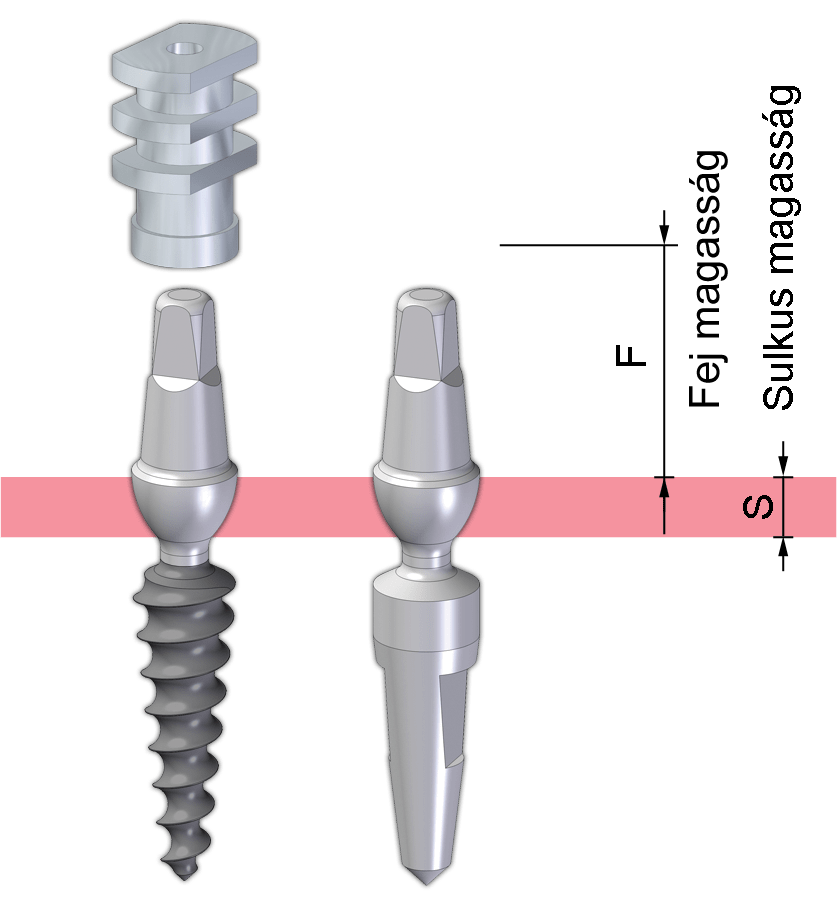 A Slim Flexible implantátum technikai implantátummal és mintavételi fejjel is rendelhető.