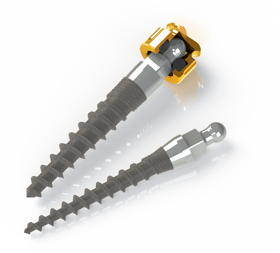 BIONIKA MDI Implant, with O-ringed cap