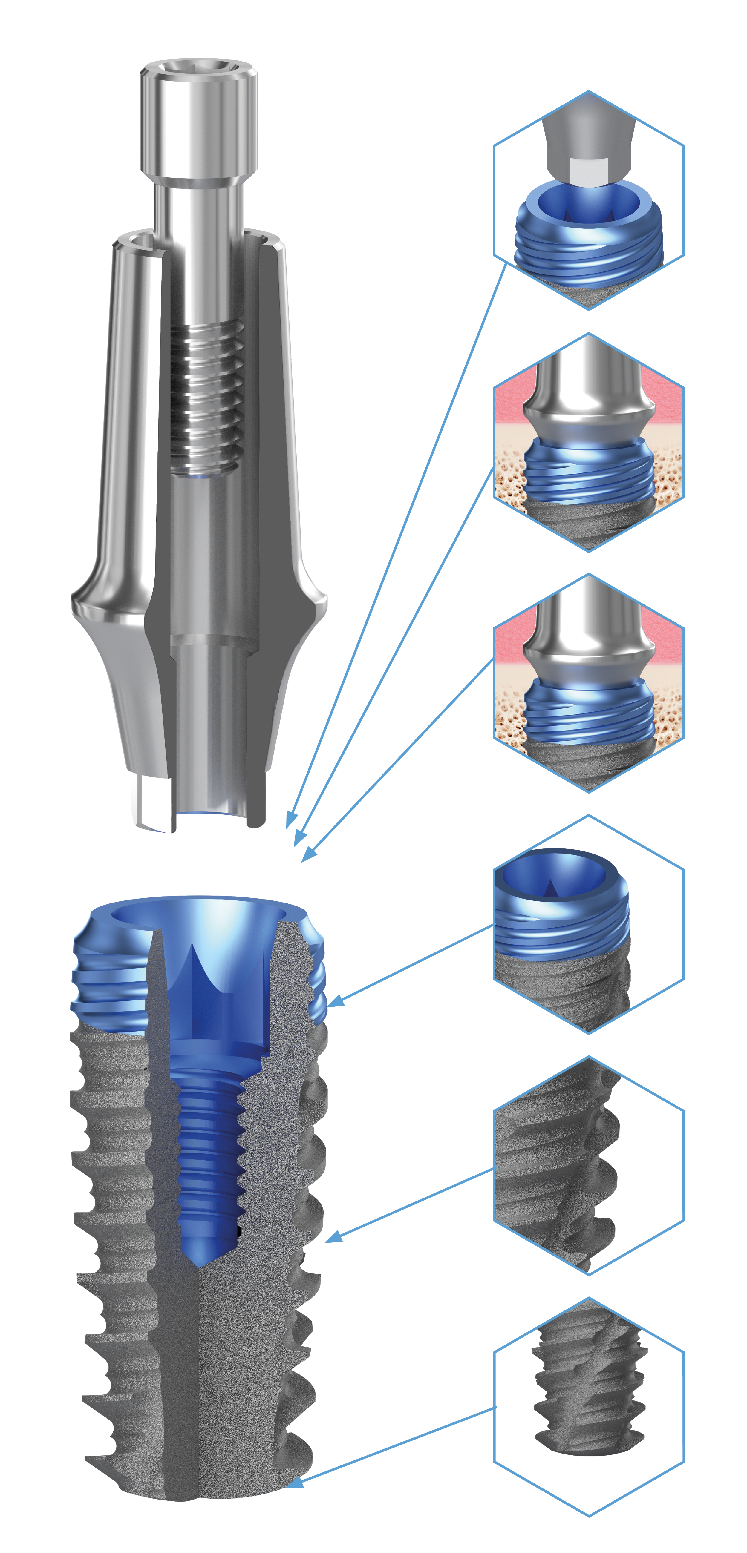 BioLevel