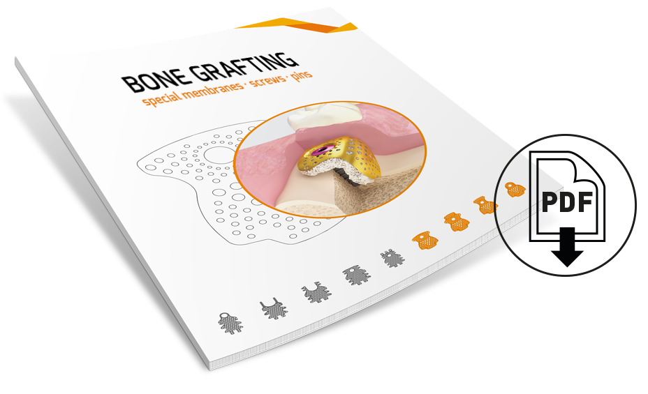 Download the BIONIKA Bone substitution catalogue!