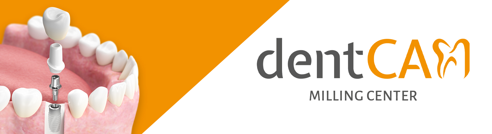 dentcam_eu