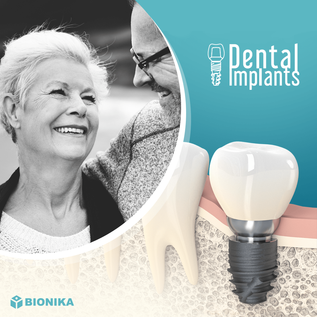 implant-2019-03 implantshop bg